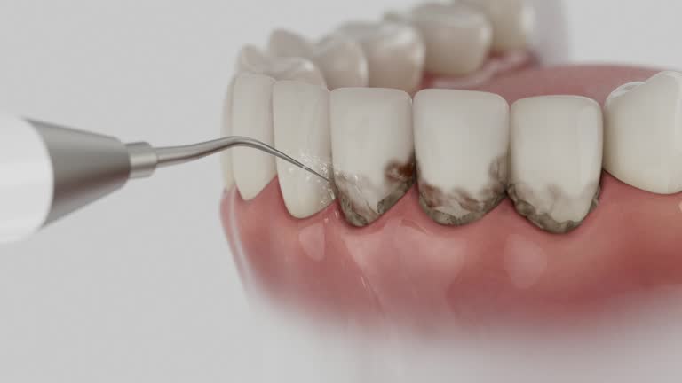 Reliable Dental Implants contractor in Brown Deer, WI by Smile Center Dentistry